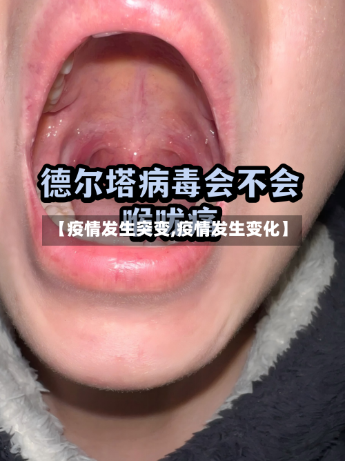 【疫情发生突变,疫情发生变化】