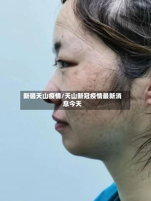新疆天山疫情/天山新冠疫情最新消息今天-第2张图片