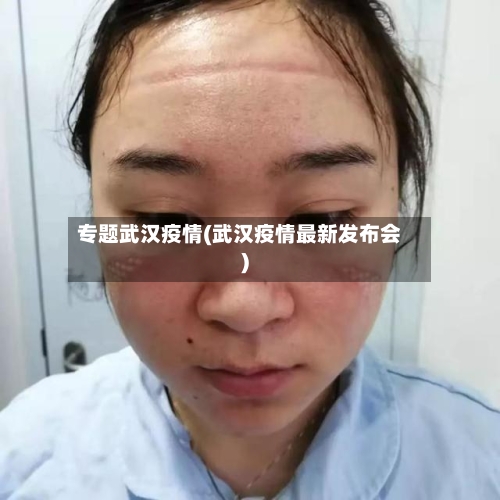 专题武汉疫情(武汉疫情最新发布会)-第2张图片