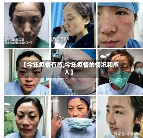 【今年疫情有感,今年疫情的情况和感人】-第2张图片