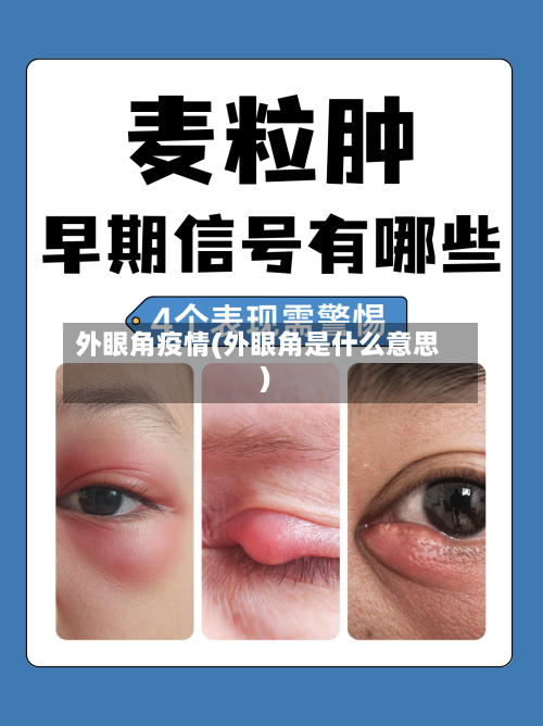 外眼角疫情(外眼角是什么意思)