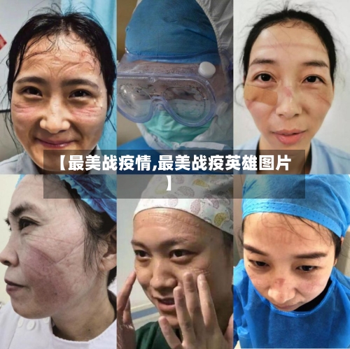 【最美战疫情,最美战疫英雄图片】-第2张图片