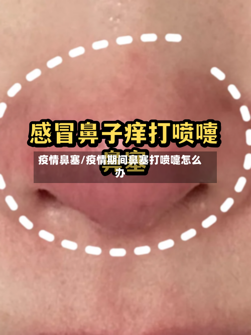 疫情鼻塞/疫情期间鼻塞打喷嚏怎么办