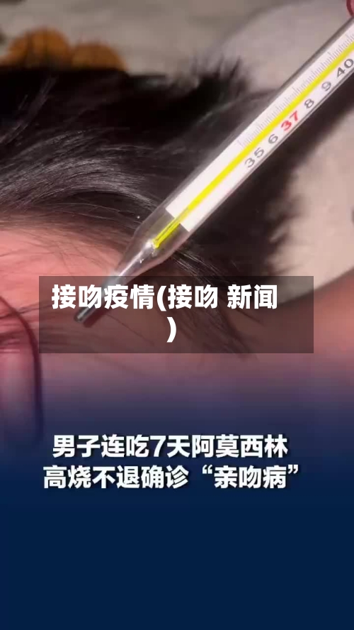 接吻疫情(接吻 新闻)-第2张图片