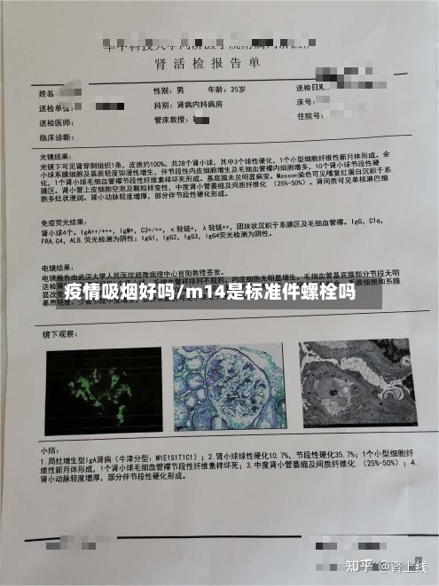 疫情吸烟好吗/m14是标准件螺栓吗-第2张图片