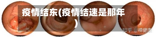 疫情结东(疫情结速是那年)