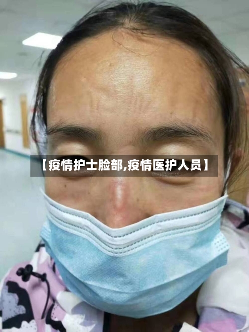 【疫情护士脸部,疫情医护人员】