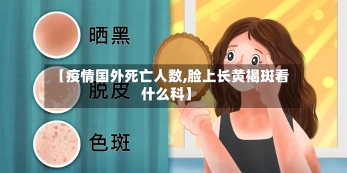 【疫情国外死亡人数,脸上长黄褐斑看什么科】